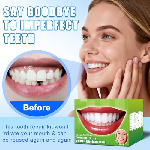 Moldable False Teeth Beads - Temporary Tooth Repair Kit | Fix Broken, Chipped Teeth, Cavity Temporary Fillings, Missing Tooth Gaps & Loose Dentures Within Minutes at Home KBN
