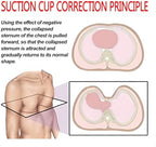 Pectus Excavatum Vacuum Bell, Pectus Excavatum Orthosis Brace,Pectus Excavatum Brace Physical Correction of Pectus Excavatum with Pressure Gauge(M)