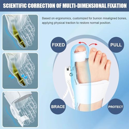 Bunion Corrector for Women & Men - Adjustable Nighttime Big Toe Straightener Bunions Splint with ABS Support for Hallux Valgus Relief Hammer Toe Brace Sleeping Home Use Left/Right Feet - 1PC Grey