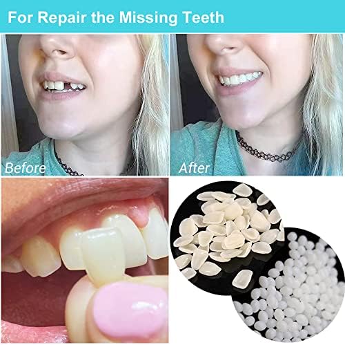 Brige Tooth Repair kit for Filling The Missing Broken Tooth and Gaps-Moldable Fake Teeth and Thermal Beads Replacement Kit for Women and Men