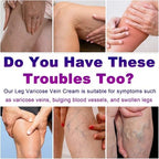 Varicose Veins Cream, Vein Cream & Spider Veins Treatment for Legs, Improves Blood Circulation and Relief From Heavy Fatigued Leg, Refreshing and Non-Sticky, 1Pack