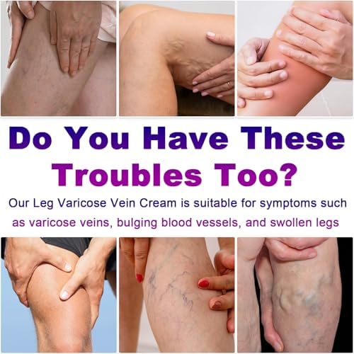 Varicose Veins Cream, Vein Cream & Spider Veins Treatment for Legs, Improves Blood Circulation and Relief From Heavy Fatigued Leg, Refreshing and Non-Sticky, 1Pack