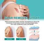 Scar Remove，Scar Remove Medical Grade Scar Spray，Etuih Scar Removal Spray，Acne Scar Treatment for Face, Acne Scars and Dark Spaot Remover, Gentle Skin Care for Acne Prone Skin (2PCS)