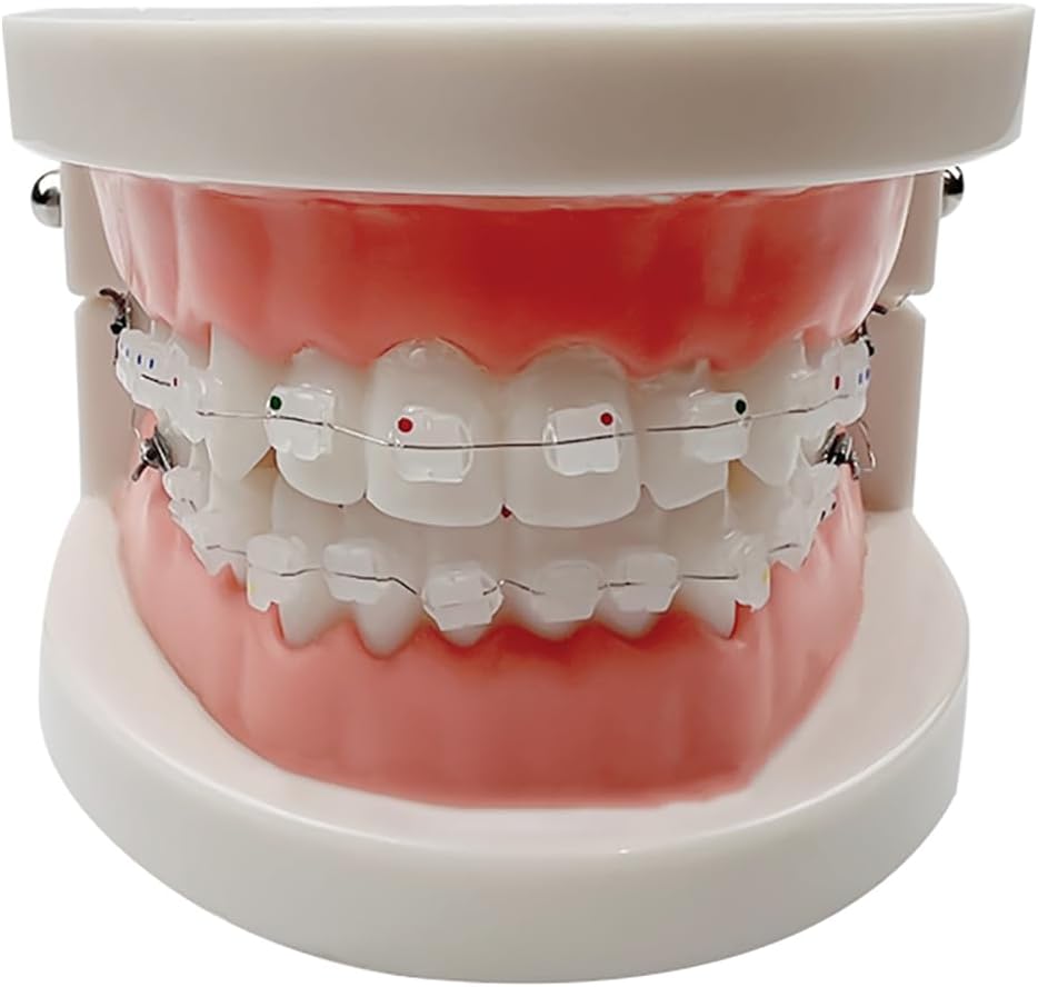 Standard Orthodontic Teeth Model, YOUYA DENTAL Demonstration Orthodontic Model Teeth Teach Study Tools with All Mouth Ceramic Bracket (All Mouth Ceramic Bracket)