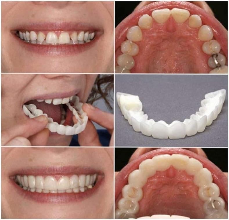 2 Pairs, Beautiful Smile,Top and Bottom, Temporarily Adjustable for Men and Women Teeth Whitening Kits(white01)