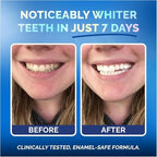 Teeth Whitening Strips for Sensitive Teeth and Gums - Peroxide Free and Enamel Safe with Coconut Oil for Gentle and Whiter Teeth - 7-Day Treatment White Strips with Non-Slip and Dry-Strip Technology