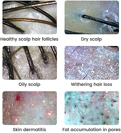 Wireless Skin Analyzer Machine Dermatoscope Scalp/Skin/Hair follicle Detection Testing Analysis Magnifier UV Skin Analyzer Professional 1000X Facial Skin Detector Digital Microscope