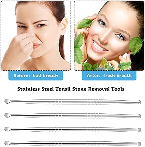 Nuanchu 4 Pieces Stainless Steel Tonsil Stone Removal Pick Tonsillolith Tool Oral Cleaner to Get Rid of Bad Breath