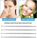 Nuanchu 4 Pieces Stainless Steel Tonsil Stone Removal Pick Tonsillolith Tool Oral Cleaner to Get Rid of Bad Breath