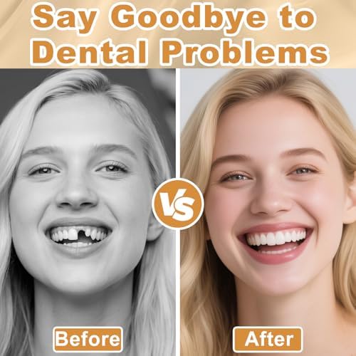 Moldable False Teeth, Dentures for Women and Men, Upper and Lower Silicone Denture Set, Fix Your Smile in Minutes, 1PCS-M