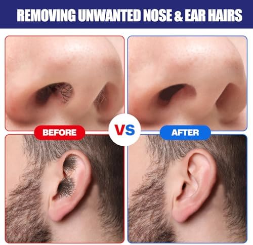 Nose Wax Kit, 120 g Wax, 30 Applicators,Nostril and Ears Hair Removal Kit for Men & Women,Includes 15 Balm Wipes and Mustache Guards etc. Lasts up to 6 Weeks
