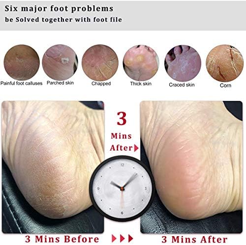 Foot File Callus Remover Foot Scrubber,Professional Pedicure Foot Rasp Removes Cracked Heels,Dead Skin,Corn,Hard Skin,Pumice Stone for Scraper File Brush Tools for Wet and Dry Feet