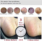 Foot File Callus Remover Foot Scrubber,Professional Pedicure Foot Rasp Removes Cracked Heels,Dead Skin,Corn,Hard Skin,Pumice Stone for Scraper File Brush Tools for Wet and Dry Feet