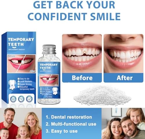 Tooth Repair Kit, Moldable False Teeth Beads for Teeth Repair, Suitable for Missing, Cracked DIY Denture Kit, 1PCS