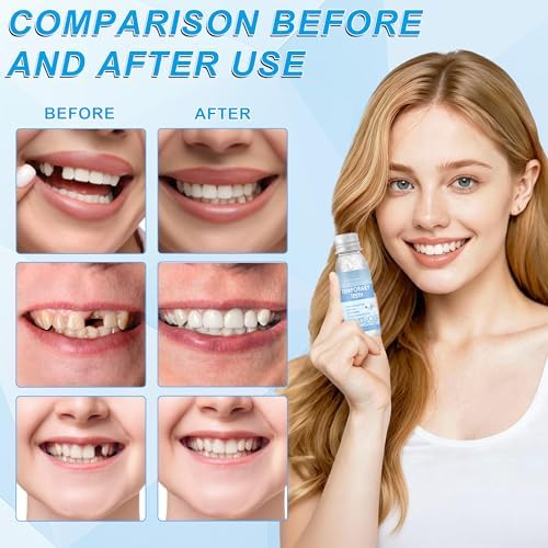 Tooth Repair Kit – 2PCS Temporary Tooth Filling, Moldable False Teeth Beads for Teeth Repair, Make You Smile Confident Again