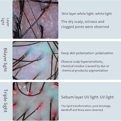 Skin Scalp Detector, 15 Inch Hair Follicle Skin Analyzer Machine with 70x/200x HD Camera,18 Million Pixels, Photo Freeze, Storage Customer Information, for Home Beauty Salon