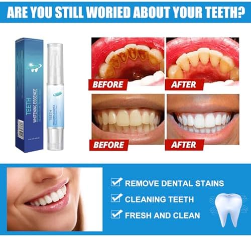 Mullend Gum Repair Gel, Qylen Gum Repair Gel, Gum Instant Treatment Teeth Whitening Essence Pen Reduce Yellowing Oral Care (2)