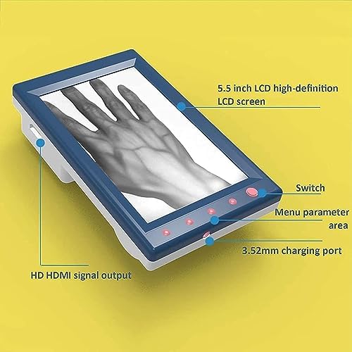 Handheld Vein Finder Viewer, Portable Infrared Vein Finder Viewer, LCD Display Instrument Vein Viewer Locator Detector for Nurses in Transilluminator, IV Phlebotomy Venipuncture Support