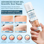 Advanced Scar Gel, Silicone Scar Gel, Treats Old and New Scars, Reduces the Appearance of Scars from, Body, Face, Stretch Marks, Surgical Scar, Keloids, Acne, Burns and More, 50g (1.7 Oz)