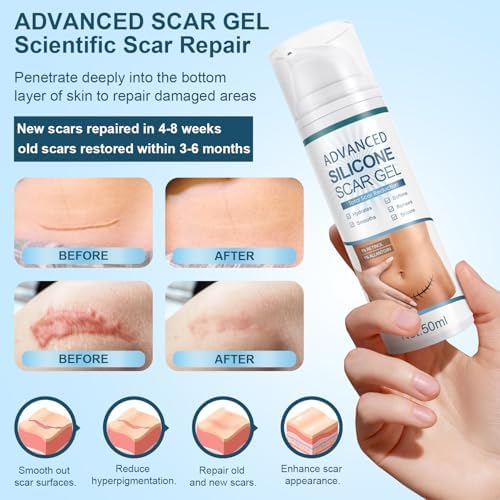 Advanced Scar Gel, Silicone Scar Gel, Treats Old and New Scars, Reduces the Appearance of Scars from, Body, Face, Stretch Marks, Surgical Scar, Keloids, Acne, Burns and More, 50g (1.7 Oz)