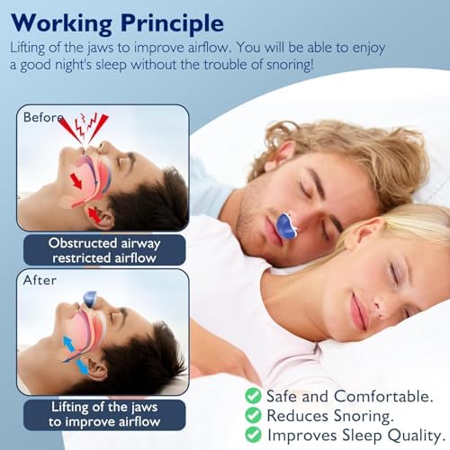 Anti Snoring Devices, Double Vortex Anti Snoring Device, Snoring Solution, Adjustable Wind Speed, Suitable for All Nose Shapes, Stop Snoring Suitable for Men and Women, Blue