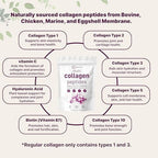 Micro Ingredients Multi Collagen Peptides Powder, 1lb – Hydrolyzed Type I,II,III,V,X with Biotin, Hyaluronic Acid, Vitamin C – Unflavored Collagen for Women & Men, Easy Dissolve, 41 Servings