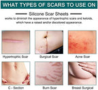 Silicone Scar Sheets (1.6” x 120” Roll-3M), Silicone Scar Tape Roll, Scar Silicone Strips, Reusable, Professional Scar Removal Sheets for C-Section, Surgery, Burn, Keloid, Acne et