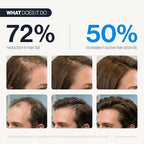 Be Bodywise Hair Growth Serum Roll On - 5% Saw Palmetto, 3% Rosemary Oil for Hair Growth, 3% Fenugreek,1% Caffeine Herbasome | Serum for Hair Loss & Hair Regrowth For Men & Women 25ml/0.84 fl oz