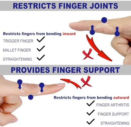 10Pcs Clear Oval Finger Splints & Sleeves Kit, 6 Graduated Trigger Finger Splint & 4 Finger Sleeves for Trigger/Mallet/Arthritis/Straightening, Finger Brace Support for Thumb/Middle/Ring/Index/Pinky(Size 1,2,3,4,5,6)