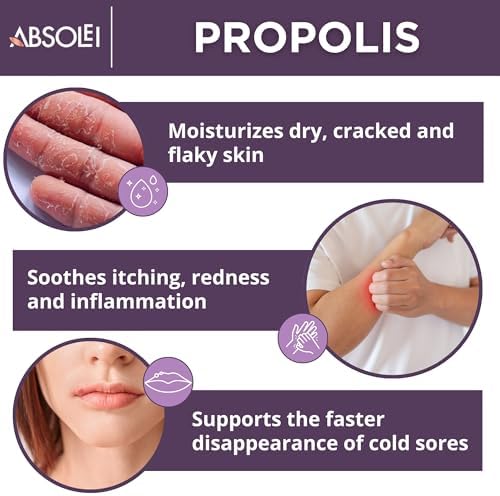 Propolis Ointment, Natural 30% Propolis Ointment for Itchy, Dry and Cracked Skin, 1.35 fl oz