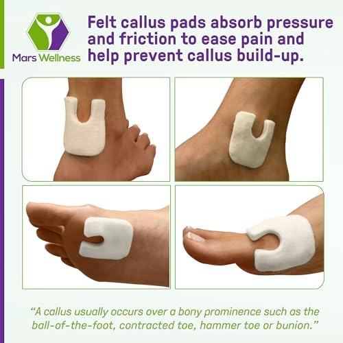 Wide U Shaped Felt Callus Horseshoe Pads - Adhesive Foot Pads That Protect Calluses from Rubbing On Shoes - 1/4" - 25 Pack