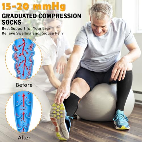 CASMON 2 Pairs Zipper Compression Socks for Women & Men, 15-20 mmHg Open Toe Knee High Support Socks for Varicose Vein Edema