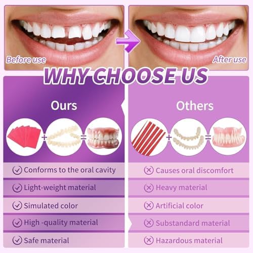 At-Home DIY Denture Kit: Full Set of Upper & Lower False Teeth for DIY Smile Transformation-MM2
