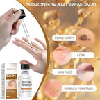 Wart Remover for Men Women,Neck, Underarms,Groin,Yellow 1