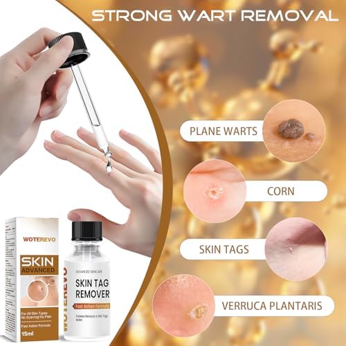 Wart Remover for Men Women,Neck, Underarms,Groin,Yellow 1