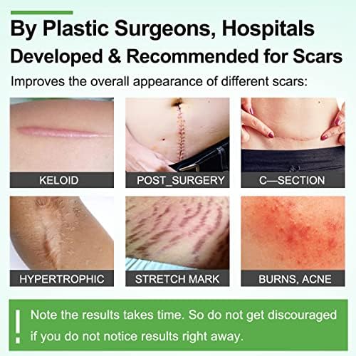 Silicone Scar Sheets(1.8” x 157”Inch- 4M), Scar Tape, Scar Strips, Medical Grade, Scar Remover, C-Section, Surgery, Keloid, Tummy Tuck, Scar Patch.