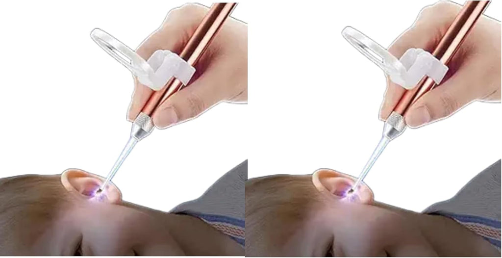 2Pcs Rose Gold Ear Wax Removal Kit,Stainless Steel Ear Wax Remover with LED Lights and Magnifier,Ear Cleansing Tool Set,Reusable Ear Curette Wax Removal Set for Children and Adults Ro Ear Care