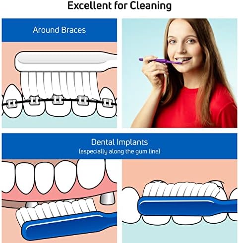 TePe Implant Orthodontic Soft Toothbrush – Extra Narrow Brush Head Thin Neck 1Pk