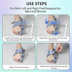 Axioms Bunion Corrector for Women – Adjustable Knob Toe Alignment & Relief Splint, Breathable Anti-Slip Bunion Brace & Straightener, Fits Left & Right Feet (Gray, 1 Pack)