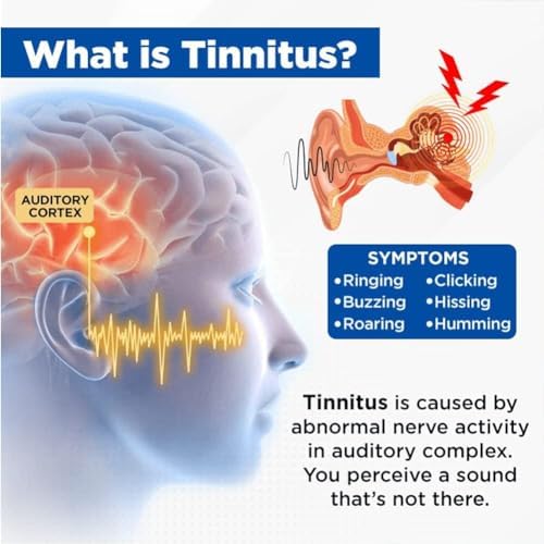 Tinnitus Relief for Ringing Ears, Acupeace Tinnitus Relief Device, Acupeace Anti Tinnitus Relief Ear Clip, Device for Stop Ear Ringing (3Pairs)