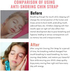 Anti-Snoring Chin Strap, Small Size Chin Strap for Snoring, Reduce Snoring - Breathable Anti Snoring Device, Sleep Aid Solution Flexible Adjustable Face Slimmer