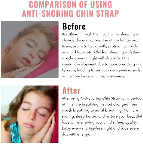Anti-Snoring Chin Strap, Small Size Chin Strap for Snoring, Reduce Snoring - Breathable Anti Snoring Device, Sleep Aid Solution Flexible Adjustable Face Slimmer