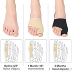2PCS Bunion Corrector for Women & Men, Big Toe Straightener Splint, Breathable Non-Slip Hallux Valgus Pain Relief, Day Night Support for Foot Care (US 5-10 Women&7-11 Men) (Black)