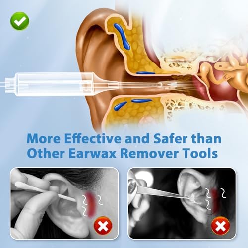Ear Vacuum Wax Remover with 3 Levels Strong, Rechargeable Reusable Ear Wax Removal Kit, Electric Ear Wax Suction Removal for Adults and Kids