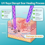 Dimora UPF50+ Silicone Scar Sheets with UV Protection Reusable Sheets to Soften, Flatten Fade Scars, Reduce Redness for Surgical, C-Section, Burn, Keloid, and Hypertrophic Scars (1.6”x78.7" Roll)