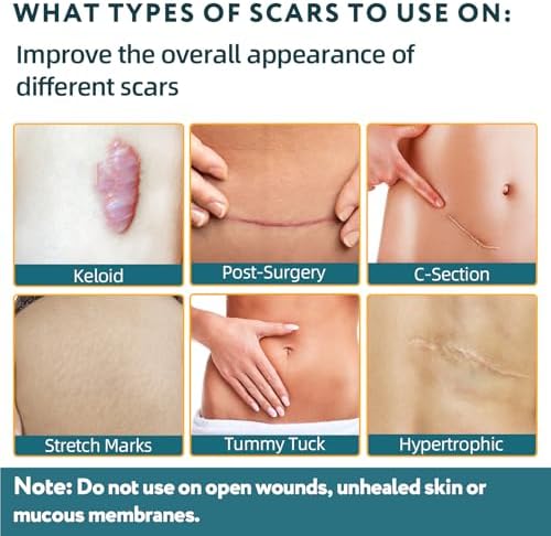 Silicone Scar Tape - 60" x 1.6" Roll - 1.5M, Scar Treatment for Improves Surgical, Keloid, Hypertrophic Scars - Medical Grade Reusable Silicone Scar Sheets