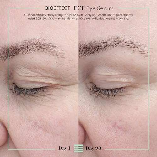 BIOEFFECT EGF Eye Serum with De-Puffer Rollerball | Age-Defying Under Eye Treatment with Epidermal Growth Factor for Fine Lines, Wrinkles, Puffiness & Sagging (6 mL + 6 mL) 12 mL / 0.40 oz