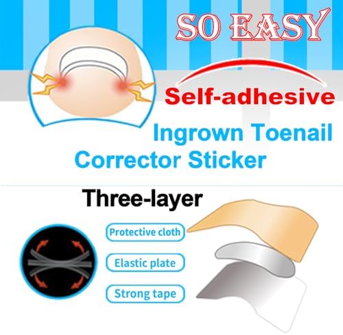 Professional Ingrown Toenail Toolkit with Breathable Ingrown Toenail Strips, Curved Toenails Corrector Patch, Painless File and Lifter for Home Pedicure Care