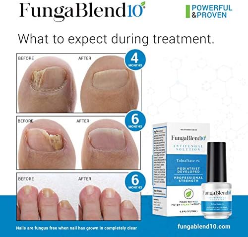 FungaBlend 10 - Antifungal Medication:1% Tolnaftate and 10 Plant Medicines -Toenail Fungus Treatment for Nail Repair Gel, Athletes Foot, Jock Itch, Ringworm -Topical Solution for Toe and Finger Nail