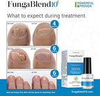 FungaBlend 10 - Antifungal Medication:1% Tolnaftate and 10 Plant Medicines -Toenail Fungus Treatment for Nail Repair Gel, Athletes Foot, Jock Itch, Ringworm -Topical Solution for Toe and Finger Nail